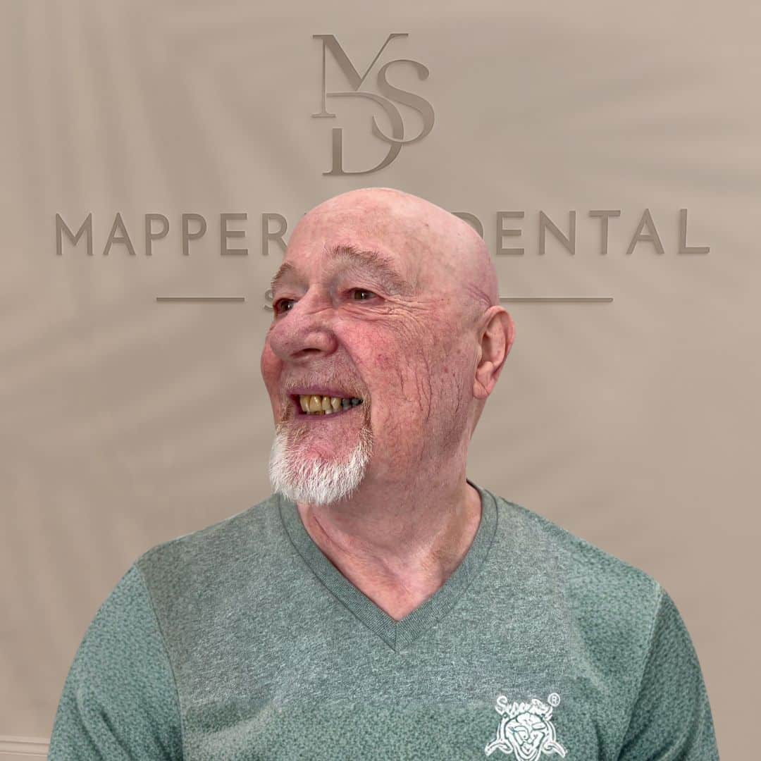 dental bridges in mapperley