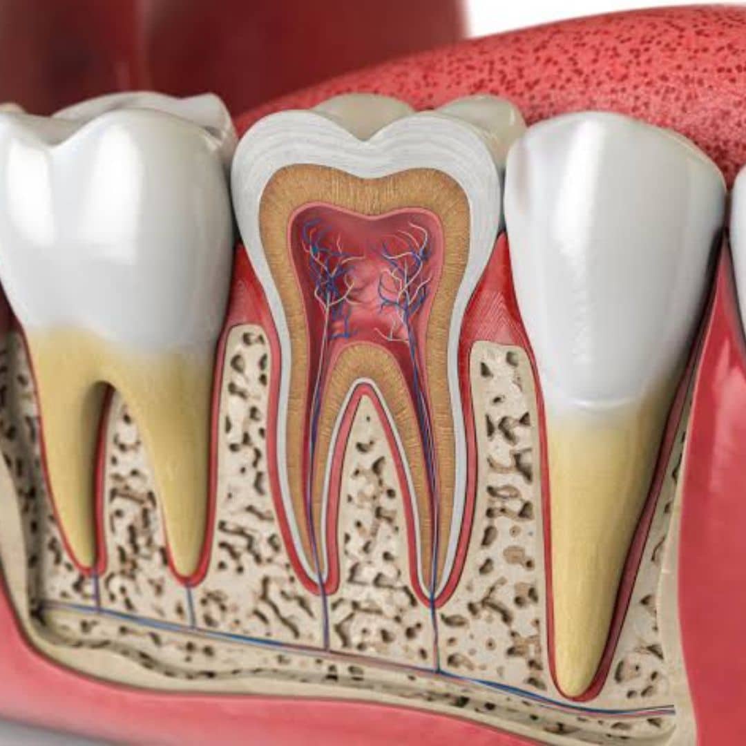 Root Canal in mapperley